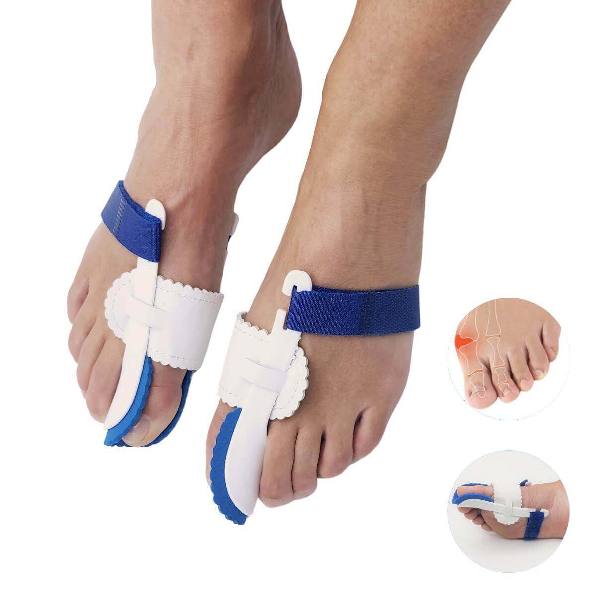 Nattåskinne til at afhjælpe og minimere smerter i knyster fra skæv storetå. Bestil knystskinne her. Køb natkinne (1 par) til tåkorrigering med hallux valgus støtte billigt hos Carerelief.dk.